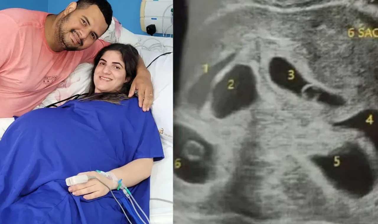Colatina: Mãe dá à luz a 06 bebês em parto de apenas 10 minutos