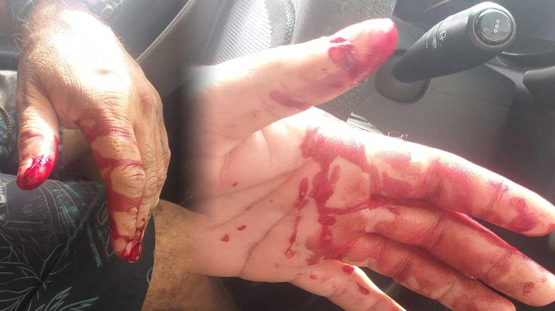Violência em Itapebi: Fiscal da prefeitura é vítima de tentativa de homicídio