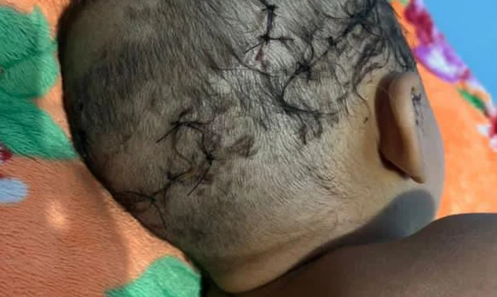 Ataque de cachorro causa ferimentos graves em criança de dois anos em Porto Seguro; Veja